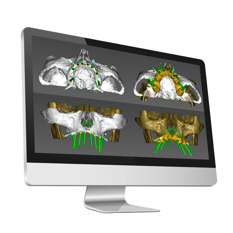 kategoria digital dentalsolutions - noris medican